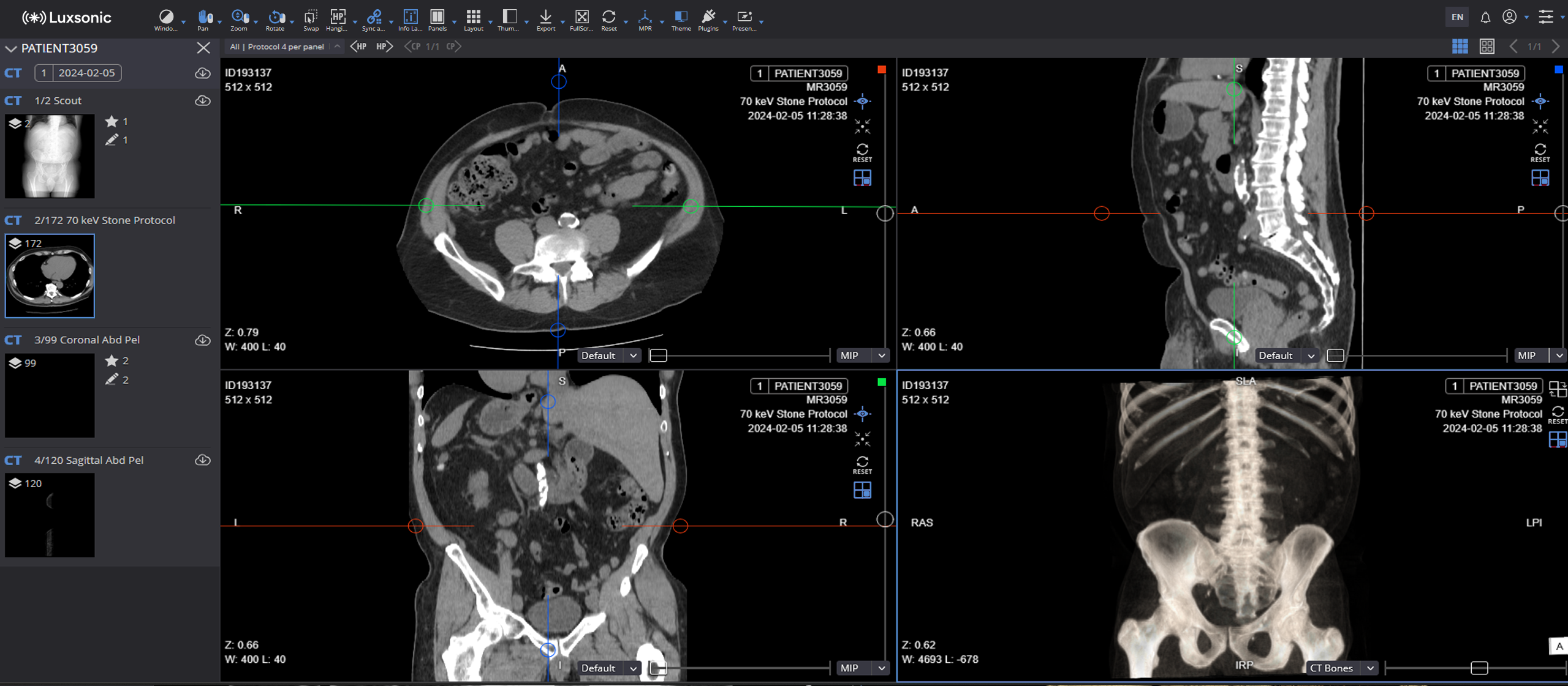 VIP Web advanced DICOM viewer